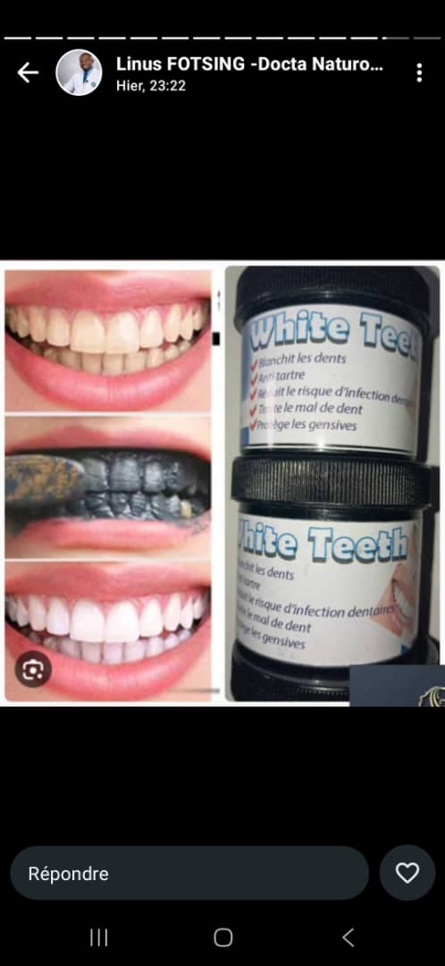 White Teeth — Blanchiment dentaire
